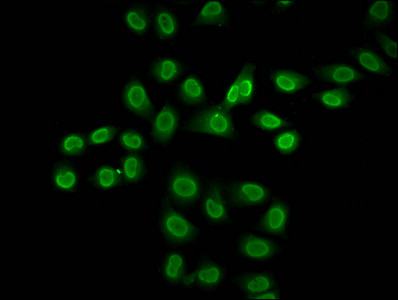 Formyl-Histone H2B (Lys116) Antibody in Immunocytochemistry (ICC/IF)