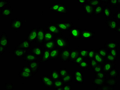 H2BK11cr Antibody in Immunocytochemistry (ICC/IF)