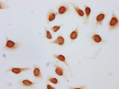 H2BK12ac Antibody in Immunocytochemistry (ICC/IF)