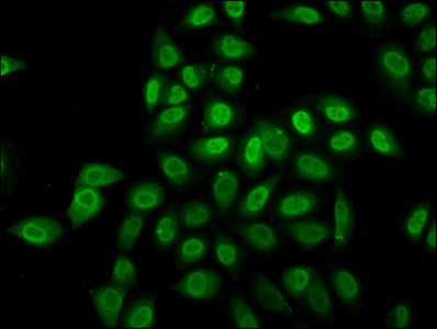 H2BK12cr Antibody in Immunocytochemistry (ICC/IF)