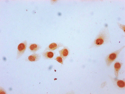 2-hydroxyisobutyryl-Histone H2B (Lys12) Antibody in Immunocytochemistry (ICC/IF)