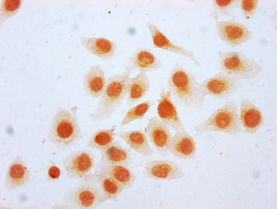 beta-hydroxybutyryl-Histone H2B (Lys20) Antibody in Immunocytochemistry (ICC/IF)