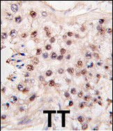 HDAC11 Antibody in Immunohistochemistry (Paraffin) (IHC (P))