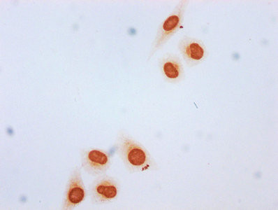 beta-hydroybutyryl-Histone H3 (Lys4) Antibody in Immunocytochemistry (ICC/IF)