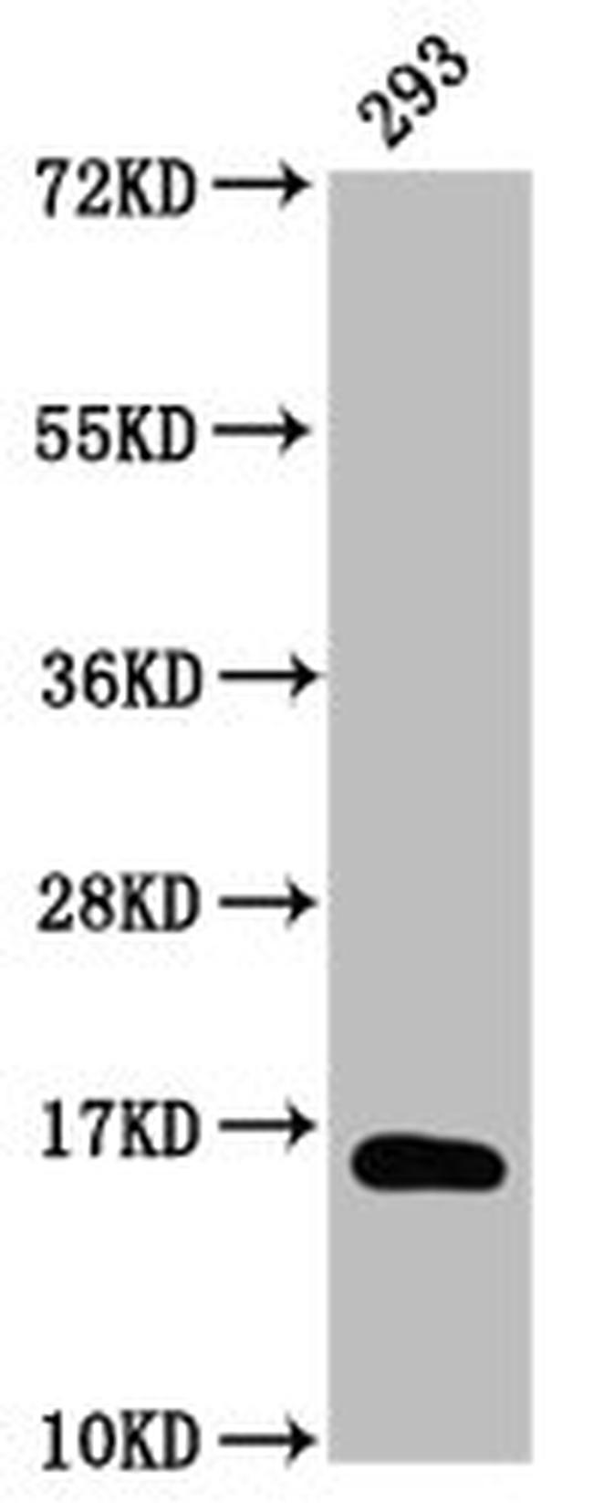 beta-hydroxybutyryl-Histone H3 (Lys9) Antibody in Western Blot (WB)