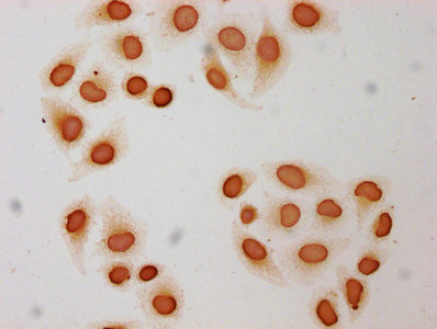Butyryl-Histone H3 (Lys9) Antibody in Immunocytochemistry (ICC/IF)