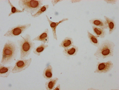 H3K122ac Antibody in Immunocytochemistry (ICC/IF)