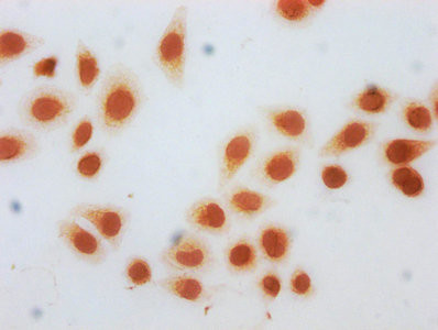 beta-hydroxybutyryl-Histone H3 (Lys122) Antibody in Immunocytochemistry (ICC/IF)