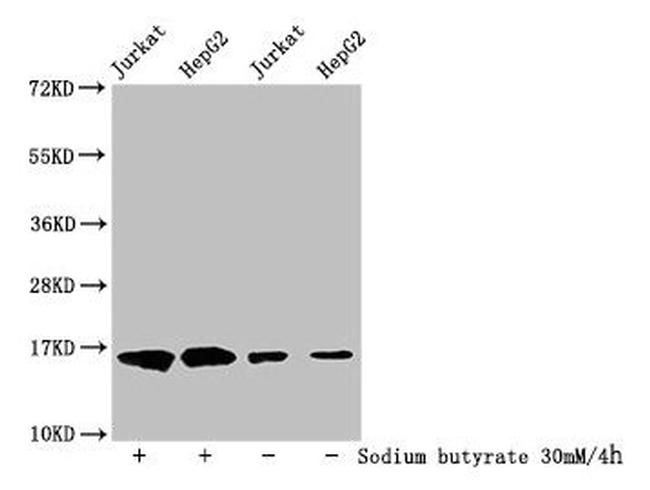 2-hydroxyisobutyryl-Histone H3 (Lys122) Antibody in Western Blot (WB)