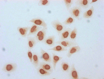 beta-hydroxybutyryl-Histone H3 (Lys18) Antibody in Immunocytochemistry (ICC/IF)