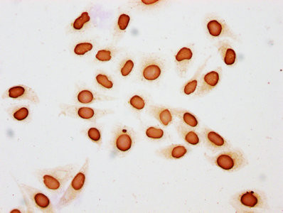 Butyryl-Histone H3 (Lys18) Antibody in Immunocytochemistry (ICC/IF)