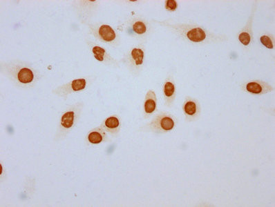 2-hydroxyisobutyryl-Histone H3 (Lys18) Antibody in Immunocytochemistry (ICC/IF)