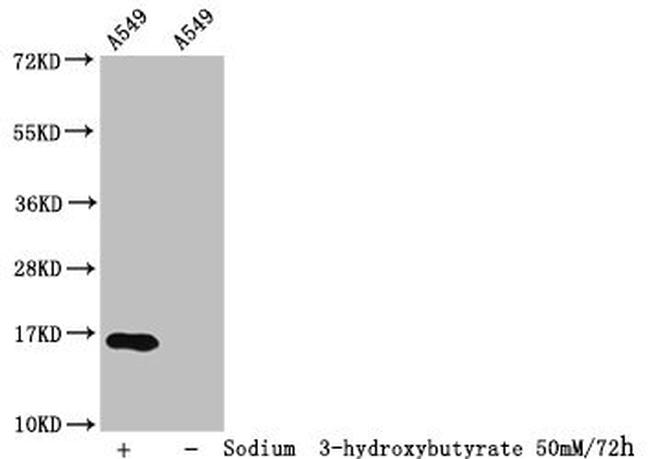 beta-hydroxybutyryl-Histone H3 (Lys23) Antibody in Western Blot (WB)