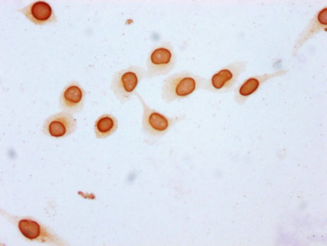 Butyryl-Histone H3 (Lys23) Antibody in Immunocytochemistry (ICC/IF)