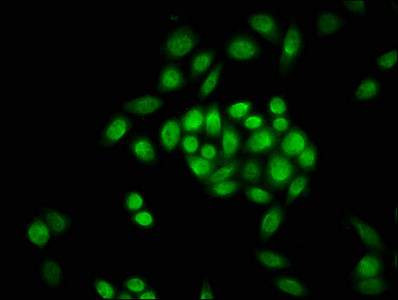 Formyl-Histone H3 (Lys23) Antibody in Immunocytochemistry (ICC/IF)