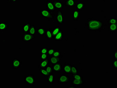 2-hydroxyisobutyryl-Histone H3 (Lys23) Antibody in Immunocytochemistry (ICC/IF)