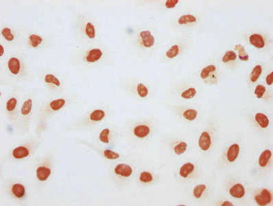 beta-hydroxybutyryl-Histone H3 (Lys27) Antibody in Immunocytochemistry (ICC/IF)