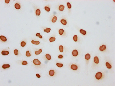 Butyryl-Histone H3 (Lys27) Antibody in Immunocytochemistry (ICC/IF)