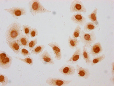 2-hydroxyisobutyryl-Histone H3 (Lys27) Antibody in Immunocytochemistry (ICC/IF)