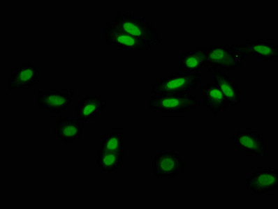 2-hydroxyisobutyryl-Histone H3 (Lys56) Antibody in Immunocytochemistry (ICC/IF)