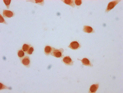 beta-hydroxybutyryl-Histone H3 (Lys79) Antibody in Immunocytochemistry (ICC/IF)