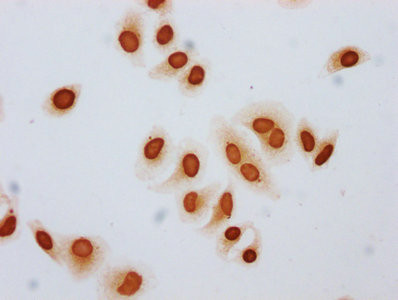 Butyryl-Histone H3 (Lys79) Antibody in Immunocytochemistry (ICC/IF)