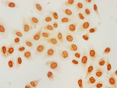 2-hydroxyisobutyryl-Histone H3 (Lys18) Antibody in Immunocytochemistry (ICC/IF)