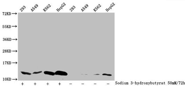 beta-hydroxybutyryl-Histone H4 (Lys5) Antibody in Western Blot (WB)