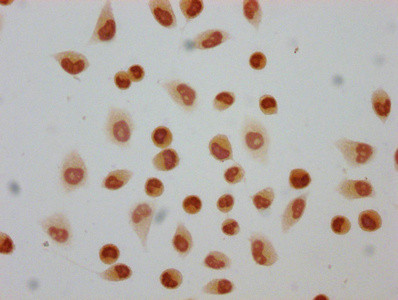 2-hydroxyisobutyryl-Histone H4 (Lys5) Antibody in Immunocytochemistry (ICC/IF)