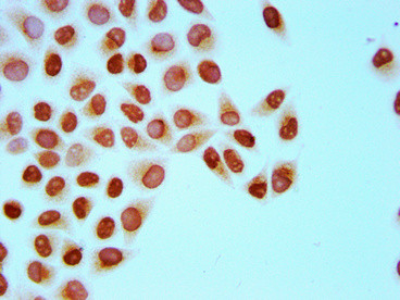 H4K8cr Antibody in Immunocytochemistry (ICC/IF)