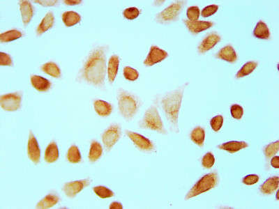 Formyl-Histone H4 (Lys12) Antibody in Immunocytochemistry (ICC/IF)