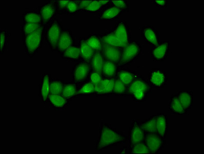 Succinyl-Histone H4 (Lys12) Antibody in Immunocytochemistry (ICC/IF)