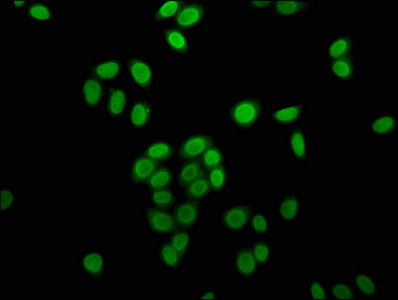Butyryl-Histone H4 (Lys16) Antibody in Immunocytochemistry (ICC/IF)