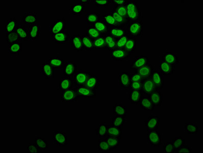 2-hydroxyisobutyryl-Histone H4 (Lys31) Antibody in Immunocytochemistry (ICC/IF)