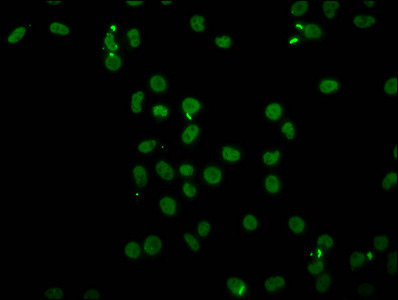 H4K91ac Antibody in Immunocytochemistry (ICC/IF)