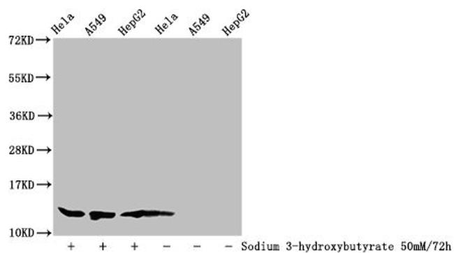 beta-hydroxybutyryl-Histone H4 (Lys91) Antibody in Western Blot (WB)