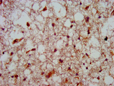 HOXA4 Antibody in Immunohistochemistry (Paraffin) (IHC (P))