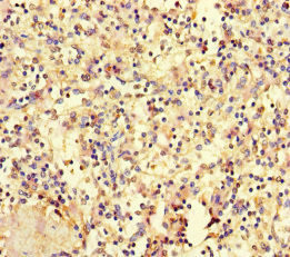 HOXD9 Antibody in Immunohistochemistry (Paraffin) (IHC (P))