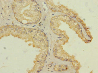 HTR3B Antibody in Immunohistochemistry (Paraffin) (IHC (P))
