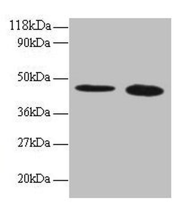 TTC1 Antibody in Western Blot (WB)