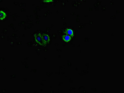 INVS Antibody in Immunocytochemistry (ICC/IF)