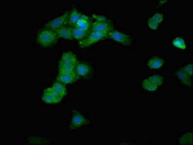 IPP Antibody in Immunocytochemistry (ICC/IF)