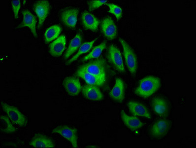 ITGB6 Antibody in Immunocytochemistry (ICC/IF)