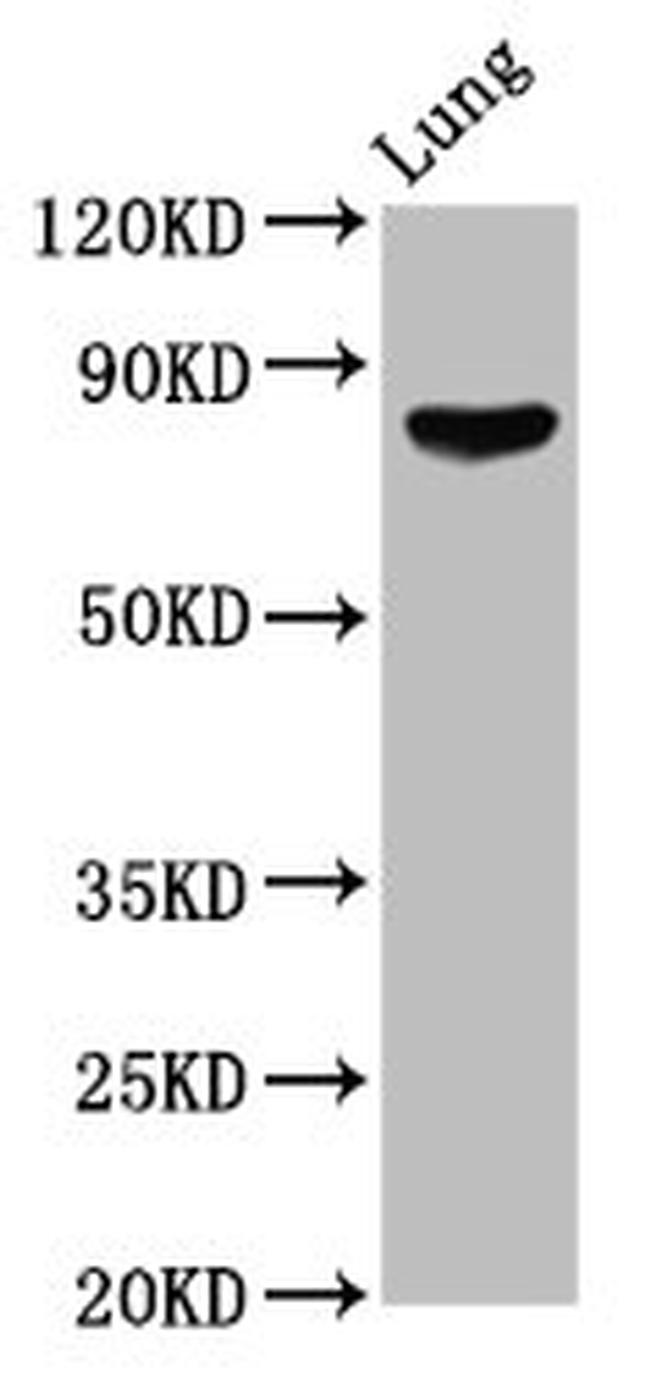 ITGB6 Antibody in Western Blot (WB)