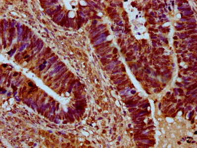 SRRM4 Antibody in Immunohistochemistry (Paraffin) (IHC (P))