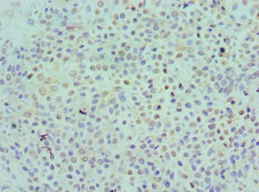 KIR2DS4 Antibody in Immunohistochemistry (Paraffin) (IHC (P))