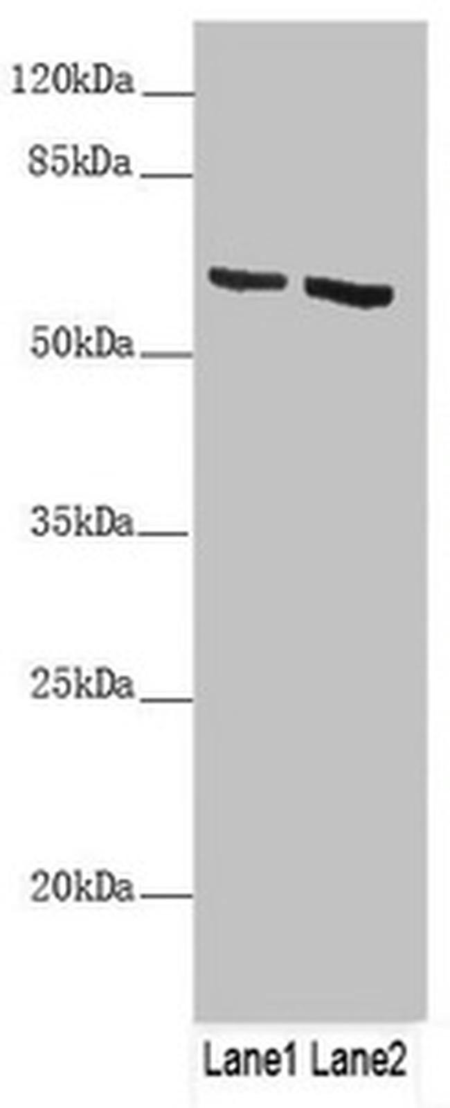 Cytokeratin 6B Antibody in Western Blot (WB)