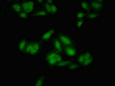 MEIS2 Antibody in Immunocytochemistry (ICC/IF)
