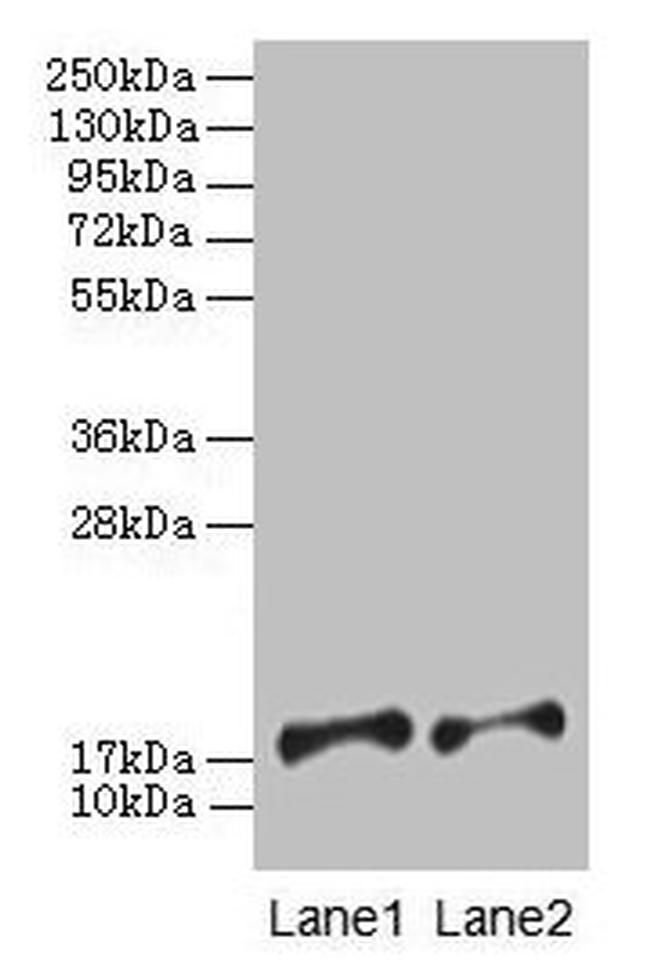 PFDN5 Antibody in Western Blot (WB)