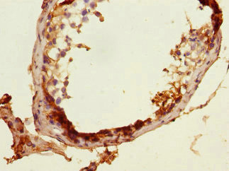 MLF1 Antibody in Immunohistochemistry (Paraffin) (IHC (P))